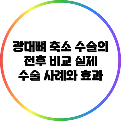 광대뼈 축소 수술의 전후 비교: 실제 수술 사례와 효과